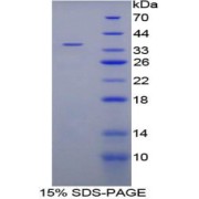 SDS-PAGE analysis of Human Cytochrome P450 21B Protein.