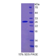 SDS-PAGE analysis of Human CYP2D6 Protein.