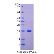 SDS-PAGE analysis of Rat CTLA4 Protein.