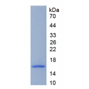 SDS-PAGE analysis of recombinant Human Debranching Enzyme Homolog 1 (DBR1) Protein.