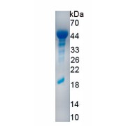 SDS-PAGE analysis of recombinant Human Desmoglein 3 Protein.