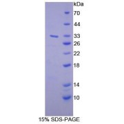 SDS-PAGE analysis of Human DGKg Protein.