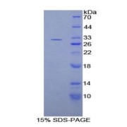 SDS-PAGE analysis of Rat DGKg Protein.