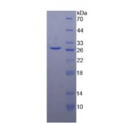 SDS-PAGE analysis of Human DGAT1 Protein.