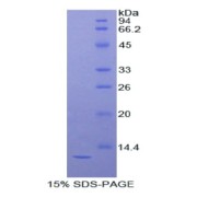 SDS-PAGE analysis of recombinant Mouse DBI Protein.