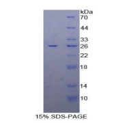 SDS-PAGE analysis of Human DLD Protein.