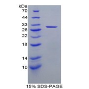 SDS-PAGE analysis of Rat DLD Protein.