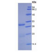 SDS-PAGE analysis of recombinant Human DPP4/CD26 Protein.