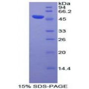 SDS-PAGE analysis of Human DVL3 Protein.