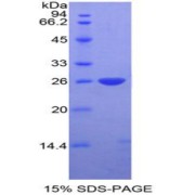 SDS-PAGE analysis of Mouse DIXDC1 Protein.