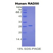 SDS-PAGE analysis of Human RAD50 Protein.