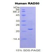 SDS-PAGE analysis of Human RAD50 Protein.