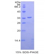 SDS-PAGE analysis of Human Dystrophin Protein.