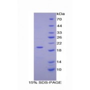 SDS-PAGE analysis of Human ENPP1 Protein.