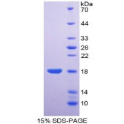 SDS-PAGE analysis of recombinant Human ENPP1 Protein.