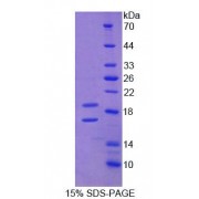 SDS-PAGE analysis of Human Endoglin Protein.