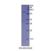 SDS-PAGE analysis of recombinant Mouse ESM1 Protein.