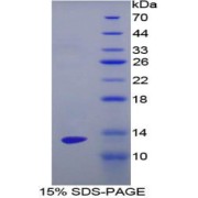 SDS-PAGE analysis of Human ENO1 Protein.