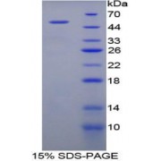 SDS-PAGE analysis of Human ENO1 Protein.