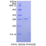 SDS-PAGE analysis of Rat Ephrin A4 Protein.