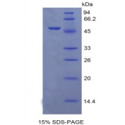 SDS-PAGE analysis of Rat EGFR2 Protein.