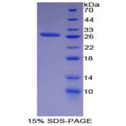 SDS-PAGE analysis of Mouse EGFR2 Protein.