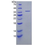 SDS-PAGE analysis of Human ENA78 Protein.