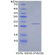 SDS-PAGE analysis of ECP Protein.