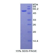 SDS-PAGE analysis of recombinant Rat ERa Protein.