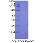 SDS-PAGE analysis of Human ERK2 Protein.