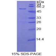 SDS-PAGE analysis of Human FASL Protein.