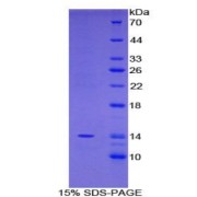 SDS-PAGE analysis of Mouse FAM19A2 Protein.