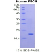 SDS-PAGE analysis of Human Fascin Protein.