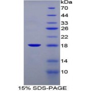 SDS-PAGE analysis of Mouse FABP1 Protein.