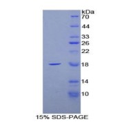 SDS-PAGE analysis of Rat FABP4 Protein.