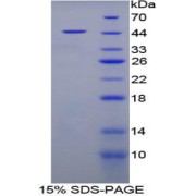 SDS-PAGE analysis of Pig FABP4 Protein.