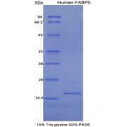 SDS-PAGE analysis of Human FABP5 Protein.