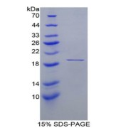 SDS-PAGE analysis of Human FABP9 Protein.