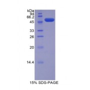 SDS-PAGE analysis of recombinant Mouse FATP5 Protein.