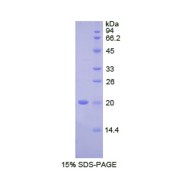 SDS-PAGE analysis of recombinant Human FcgBP Protein.