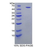 SDS-PAGE analysis of recombinant Rat FcgR3A Protein.