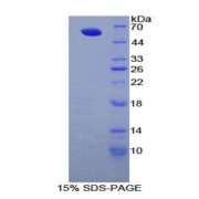 SDS-PAGE analysis of Human Fibrillin 1 Protein.