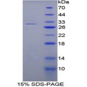 SDS-PAGE analysis of Mouse Fibrinogen alpha Protein.