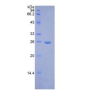 SDS-PAGE analysis of Human FGF9 Protein.