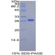 SDS-PAGE analysis of Mouse FGFRL1 Protein.
