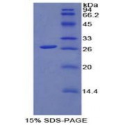 SDS-PAGE analysis of Rat FGFRL1 Protein.