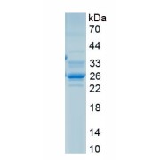 SDS-PAGE analysis of recombinant Chicken Fibronectin Protein.