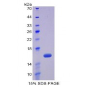 SDS-PAGE analysis of recombinant Human Fibronectin Protein.