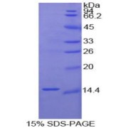 SDS-PAGE analysis of recombinant Human Fibronectin Protein.