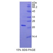 SDS-PAGE analysis of Rat Fibulin 5 Protein.